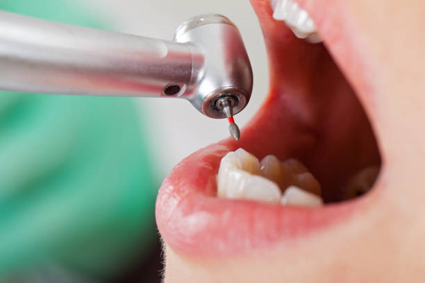 Best Urgent Tooth Repair  in Fairhope, PA